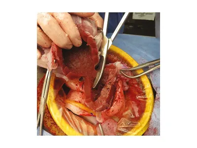 1022564 Тренажер навыков неотложной гистерэктомии C-Celia