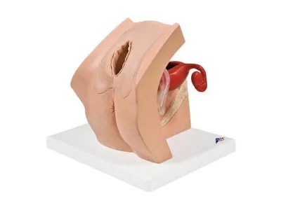 1013705 Обучающая гинекологическая модель для медицинского просвещения пациентов