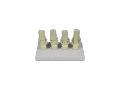 ZM2087 Модель патологий коленного сустава в разрезе