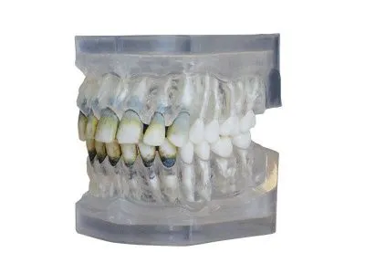М0319 Денто-модель верхней и нижней челюстей для лечения пародонтоза ЧВН-28П