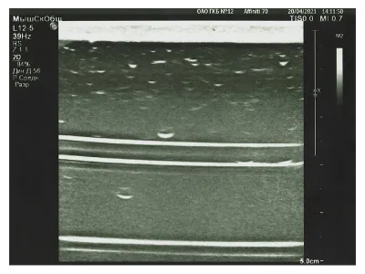 310_Фантом_УИ-1.01.П_2