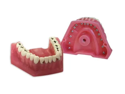 М0360 Денто-модель верхней и нижней челюстей для лечения кариеса ЧВН-32К