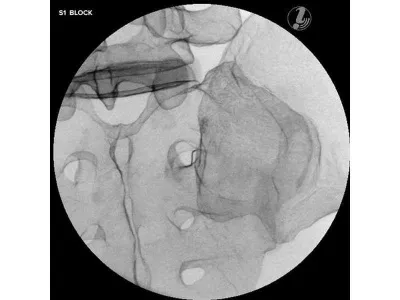 1021898 Тренажер для спинальных инъекций с визуальным контролем