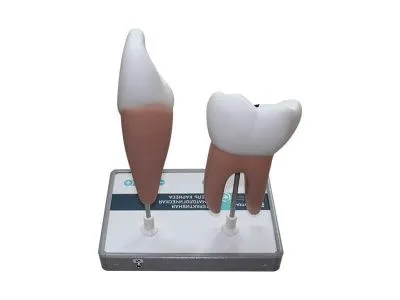 М0041 Интерактивная стоматологическая модель кариеса