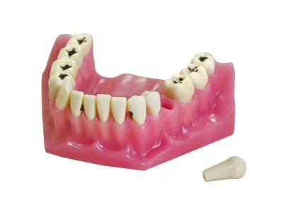 М0360 Денто-модель верхней и нижней челюстей для лечения кариеса ЧВН-32К