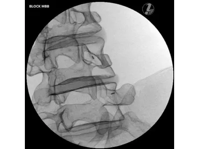 1021898 Тренажер для спинальных инъекций с визуальным контролем