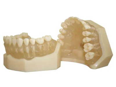 М0402 Денто-модель верхней и нижней челюстей с прозрачными деснами для удаления ЧВН-28УП