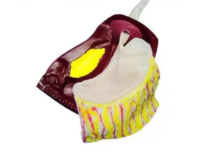 МУ0445 Лапароскопическая модель для отработки этапов фундопластики (операции Ниссена)