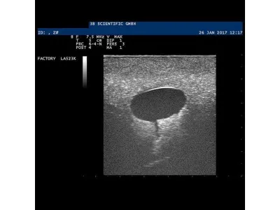 1019634 Модель молочной железы с кистами SONOtrain™ с возможностью УЗИ-обследования