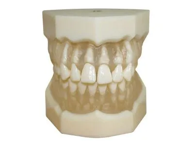 М0402 Денто-модель верхней и нижней челюстей с прозрачными деснами для удаления ЧВН-28УП