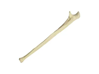 310_Композитная_локтевой