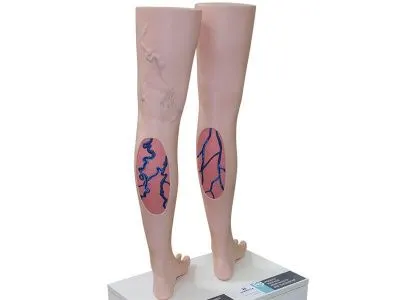 М0548 Модели нижних конечностей взрослого человека, для демонстрации варикозного заболевания вен