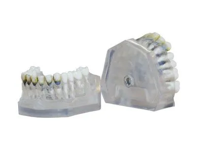 М0319 Денто-модель верхней и нижней челюстей для лечения пародонтоза ЧВН-28П