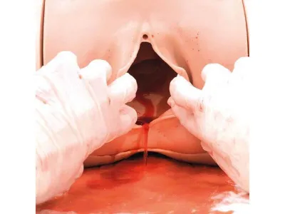 1021568 Тренажер остановки послеродового кровотечения