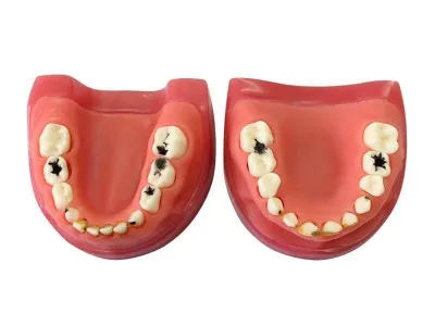 М0253 Денто-модель с патологиями ЧВН-24П