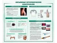 310_МУ0258_Стенд_Несъёмные_ортопедические_конструкции