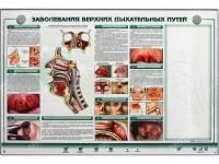 310_Заболевания_верхних_дыхательных_путей